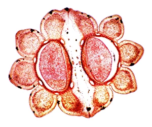 Light Microscopy Images Impressions: Fools parsley fruit, light micrograph