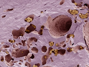 Scanning Electron Microscope Images Impressions: Fossilised compact bone, SEM