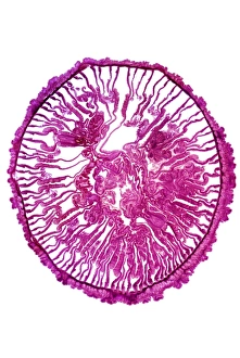 Light Micrograph Impressions: Gem anemone, light micrograph