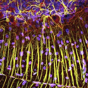Graphiques Et Motifs Impressions: Tissu du cervelet, photographie à microscope légèrement amplifié