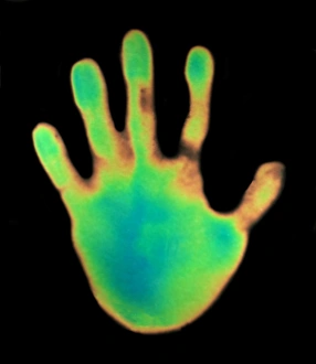 Thermography Images Impressions: Hand, thermogram
