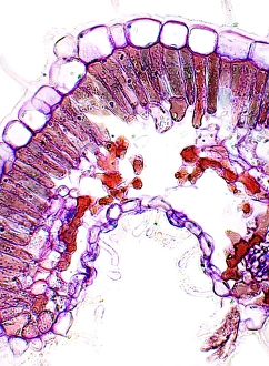 Drought Resistant Plants Impressions: Heather leaf, light micrograph