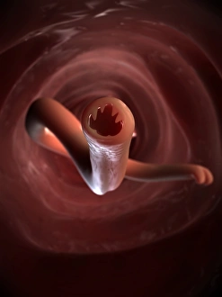 Intestinal Parasites Impressions: Hookworm, artwork