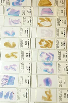 Images datées de 2006: Microscope des cerveaux humains