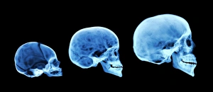 Impressions de Le développement du squelette humain. Un radiographie colorée de trois squelettes humains, comprenant un nouveau-né, un enfant et une personne adulte Images datées de 2006 avril: Développement du crâne humain