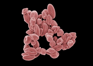 SEM Images Of Pollen Impressions: Hypericum pollen