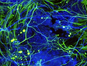 Cellules de nerf induites, micrographie