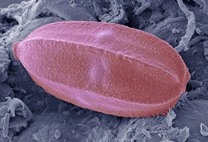 Coloured SEM Images Impressions: Insect egg, SEM