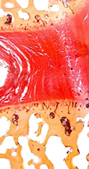 Light Micrograph Impressions: Intervertebral disc, light micrograph