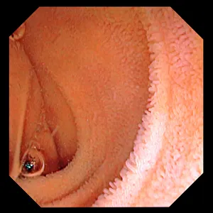 Images datées de 2012 avril: Manteau intestinal