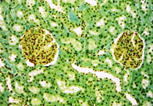 Images datées de 2007 octobre: Glomérules rénaux, image à microscope léger
