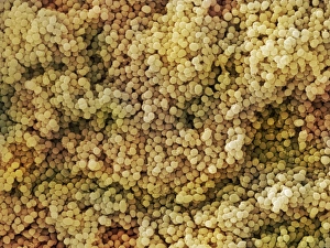 Scanning Electron Micrograph SEM Impressions: Lactococcus sp. Bacteria (SEM)