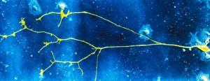 Human Nervous System Anatomy Impressions: Light micrograph of a nerve cell