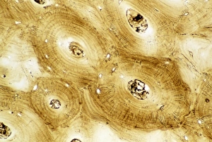 Images datées de 2003 octobre: Micrograph de lumière d'os humain compacts normaux