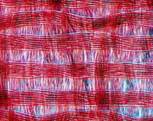 Light Microscopy Images Impressions: Light micrograph of polyamide in tissue