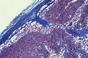 Human Immune System Cells Impressions: Lymph node, light micrograph C015 / 6222