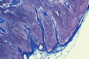 White Blood Cell Types Impressions: Lymph node, light micrograph C015 / 6223