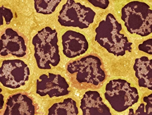 Immune System Cells Impressions: Lymph node, TEM