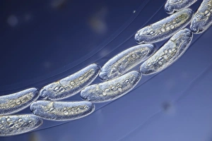 Light Micrograph Images Impressions: Midge eggs, light micrograph