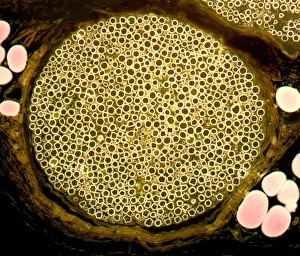 Myelin Sheath Structure Impressions: Nerve bundle, light micrograph