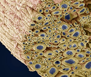 Myelinated Nerve Fibres Impressions: Nerve bundle, SEM
