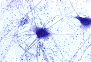 Nerve Cells Impressions: Nerve cells, light micrograph
