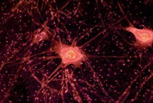 Impressions de Les cellules du nerf ou les neurones sous microscope à l'éclairage de microscopie Images datées de 2008 juillet: Cellules nerveuses sous microscope de lumière