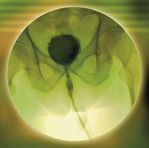 Bladder normal, radiograph de la cysto-uréthre