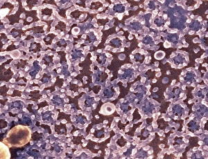 Cell Nucleus Structure Impressions: Nuclear pore complexes, SEM