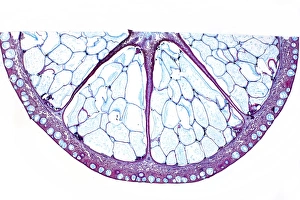 Impressions de Le fruit orange. Micrographie lumineuse d'une section travers le fruit d'un arbre à citron amère (Citrus aurantium), montrant les grandes septa (segments) Images datées de 2012 janvier: Fruit d'orange, image de microscope à faible puissance