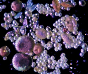Light Microscopy Images Impressions: Pollen, light micrograph