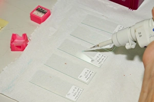 Impressions de Préparation de lames à poudre pollinique pour les observer sous un microscope optique. Photo prise à l'Université de Haïfa Images datées de 2011 décembre: Préparation d'une lame de pollens en exemple