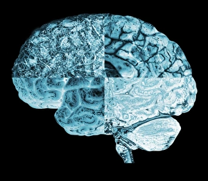Neurology Images Impressions: Quartered brain