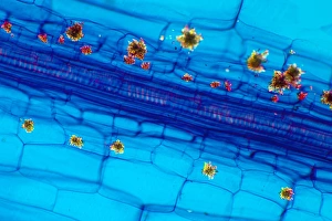 Polarised Light Microscopy Impressions: Rhubarb leaf, light micrograph