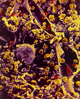 Human Body Bone Structure Impressions: SEM of bone marrow