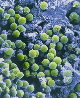 Human Immune System Cells Impressions: SEM of lymphocytes in cortex of thymus