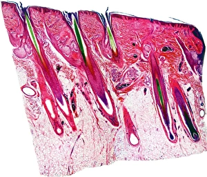 Epidermis And Dermis Layers Impressions: Skin section, light micrograph