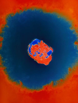 Smallpox Virus Impressions: Smallpox virus
