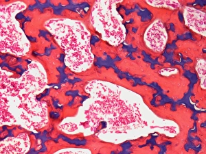 Os vertébral, microscope à lumière légère