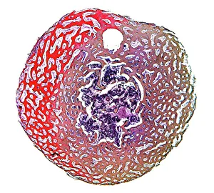 Cancellous Bone Structure Impressions: Spongy bone, light micrograph