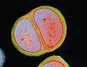 Images datées de 2003 décembre: Bactérie Staphylocoque épidermique