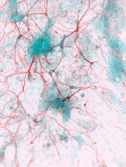 Impressions de Les neurones issus de la stématocèle humaine. Micrographie à lumière du cerveau humain (neurones) qui ont été dérivés des cellules pluripotentes stimulées (CPS) Images datées de 2012 décembre: Cellules souches différenciées en neurones, micrographie