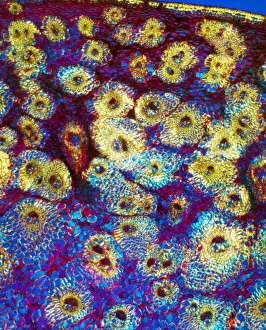 Plant Vascular System Impressions: Sugar cane stem, light micrograph