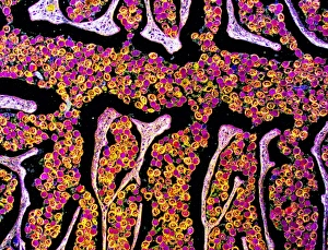 Intestinal Parasites Impressions: Tapeworm proglottid, light micrograph