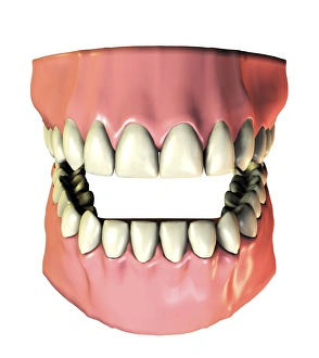 Impressions de Dents et gencives, Artwork informatique de dents saines et de gencives sains chez les adultes ont 32 dents permanentes Images datées de 2006 août: Dents et gencives