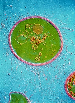 Images datées de 1988: Cryptococcus néoforum