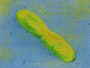 Escherichia Coli Micrograph Impressions: TEM of E. coli bacterium