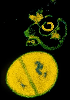 Antibiotic Resistant Bacteria Impressions: TEM Staphylococcus aureus