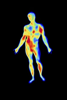 Thermography Images Impressions: Thermogram