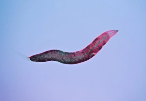 Intestinal Parasites Impressions: Threadworm, light micrograph